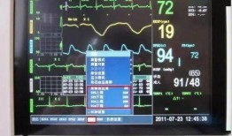 心电监护仪的操作视频,轻松掌握生命体征监测技巧